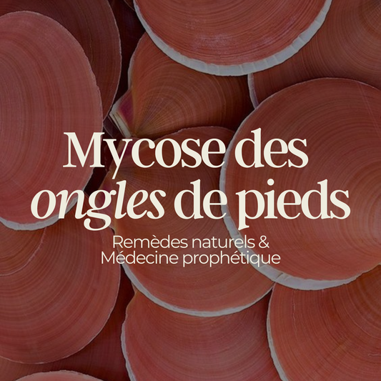 Mycose des ongles des pieds : remède naturel et médecine prophétique